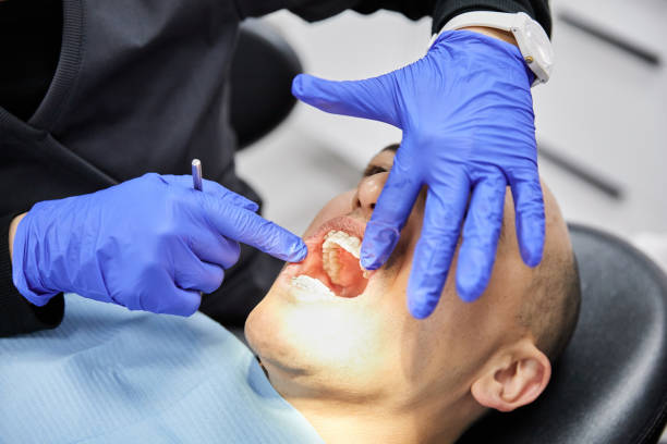 Best Knocked-Out Tooth (Avulsed Tooth) Treatment in Pablo, MT